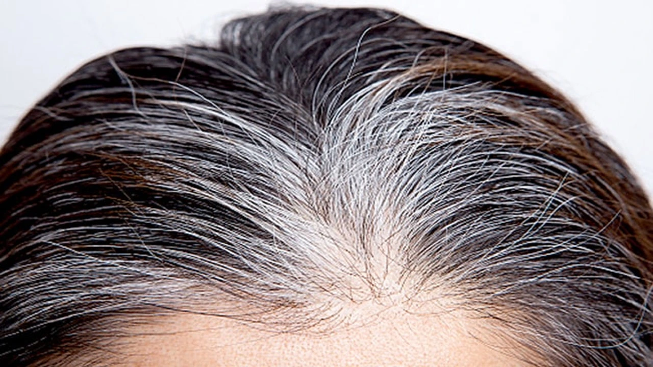 उम्र नहीं, पोषण की कमी की चेतावनी देते हैं सफेद बाल, कैसे पाएं इससे छुटकारा